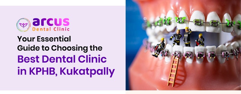 Best Dental Clinic in KPHB, Kukatpally