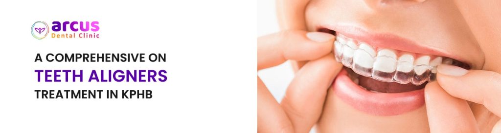 Teeth Aligners Treatment in KPHB