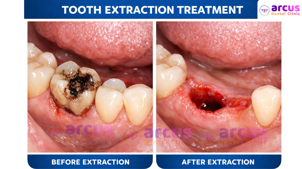 Top Dental Clinic Near JNTU