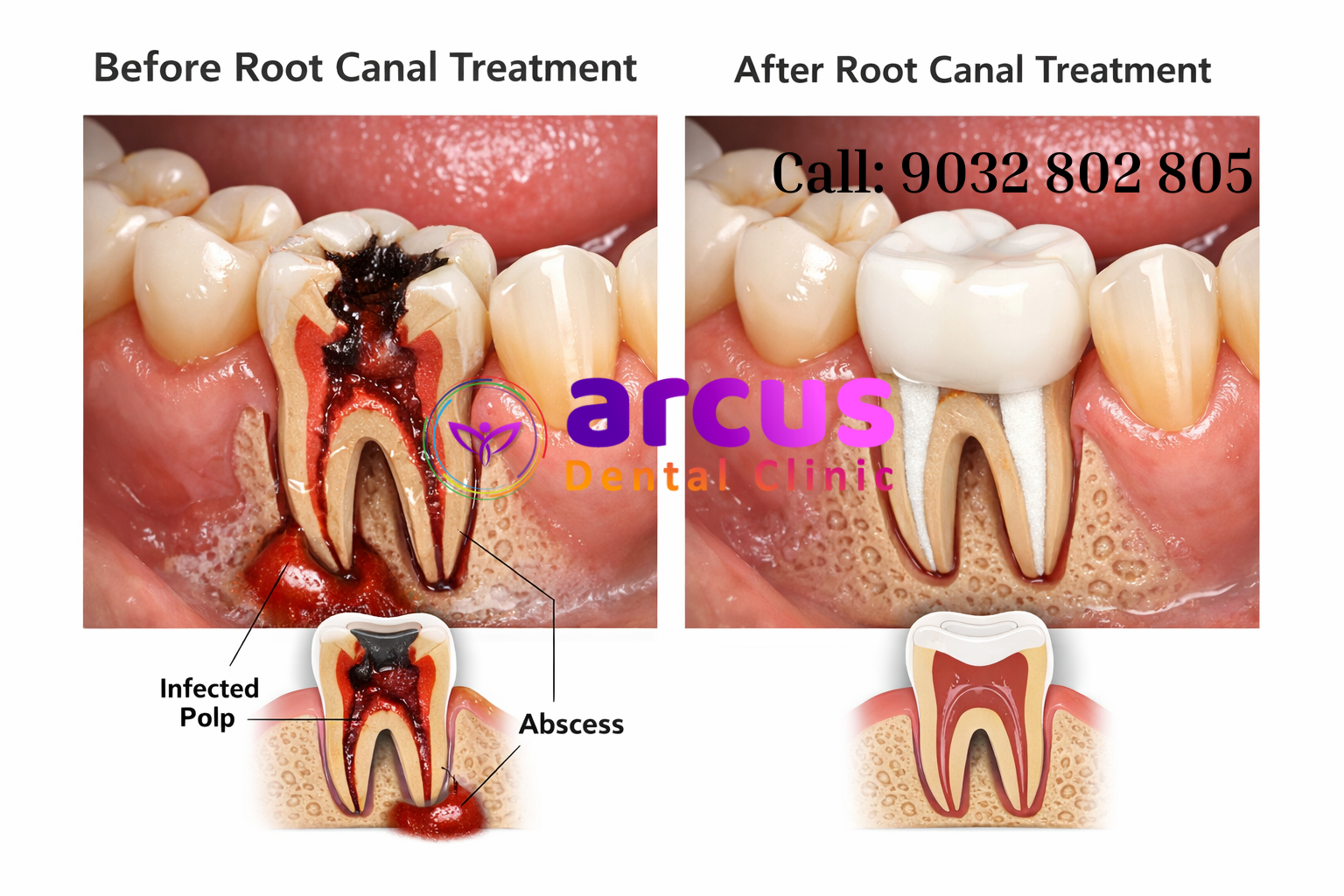 Best Dental Clinic Near Indis Onecity