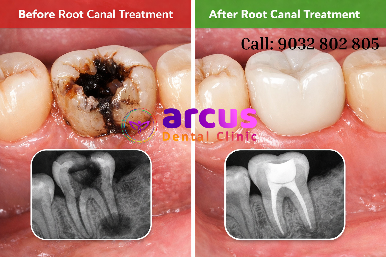 Best Dental Clinic Near Indis Onecity