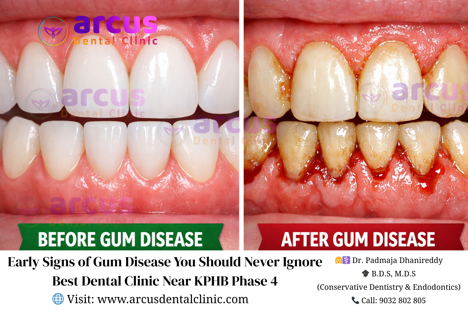 Best Dental Clinic Near KPHB Phase 4