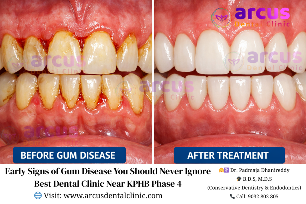 Best Dental Clinic Near KPHB Phase 4