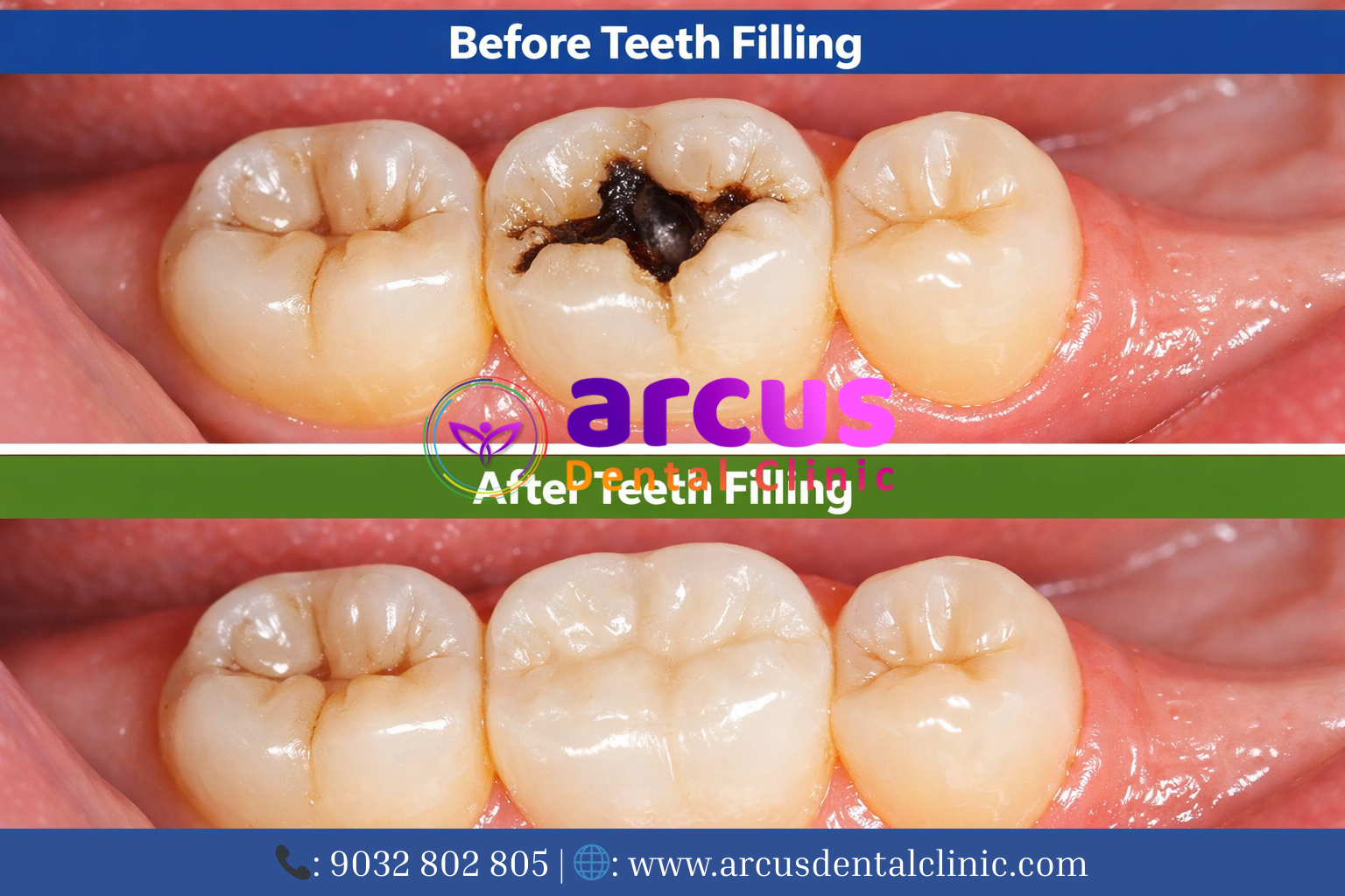 Best Dentist Near KPHB Phase 6