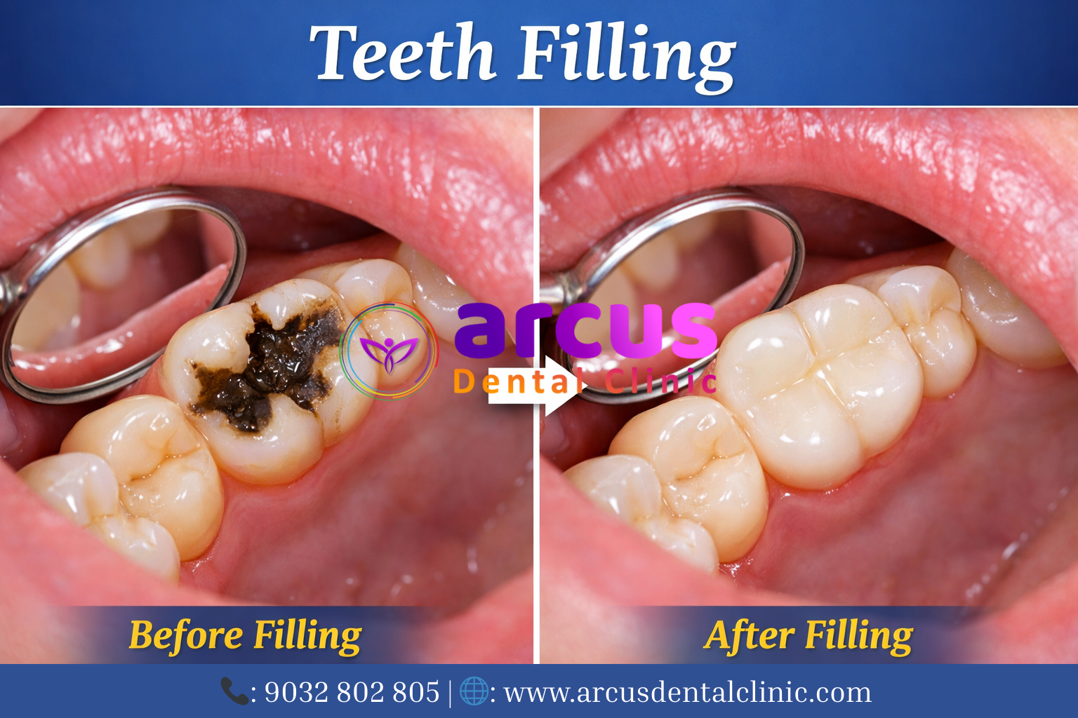 Best Dental Clinic near KPHB Phase 6