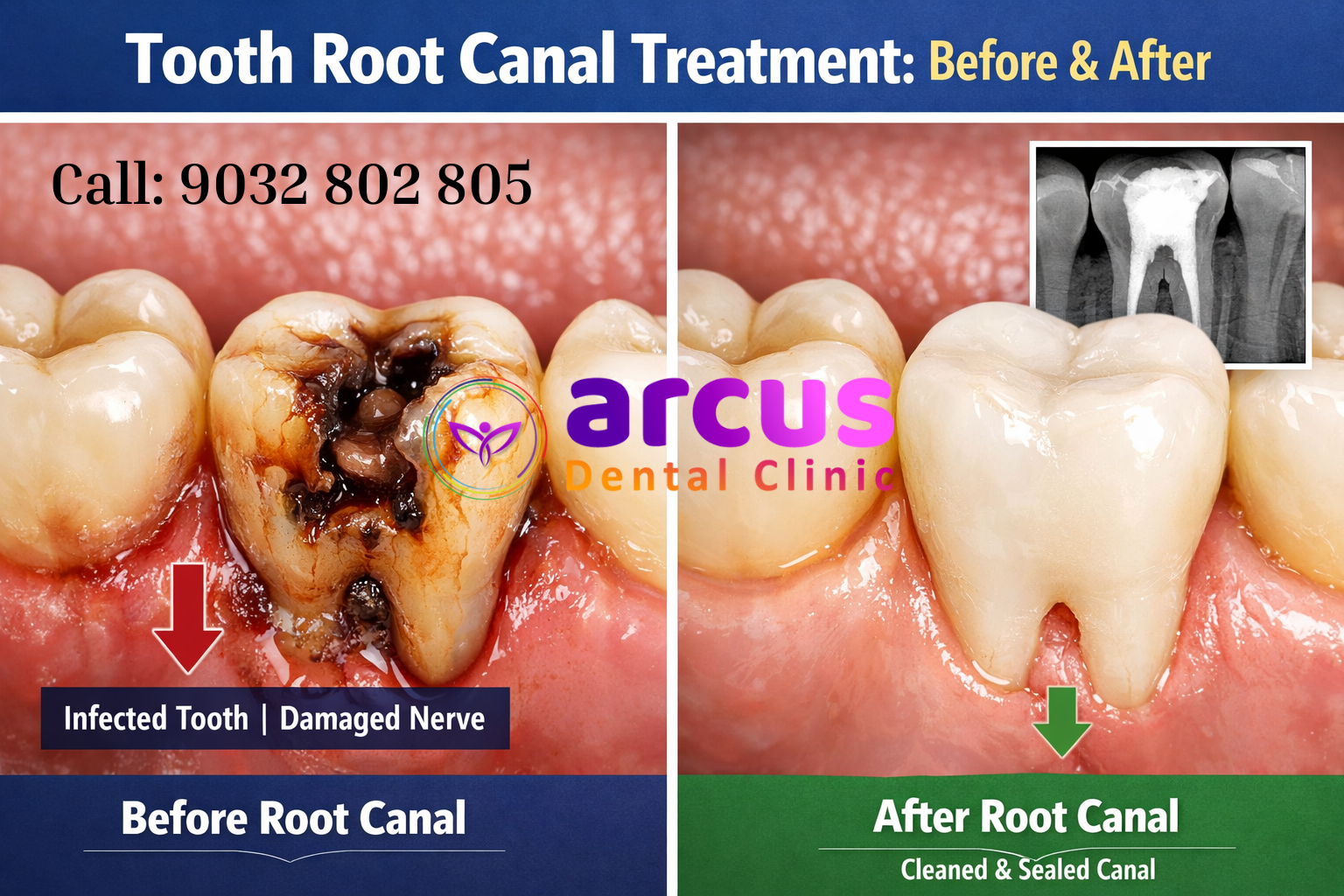 Best Dentist Near Indis OneCity