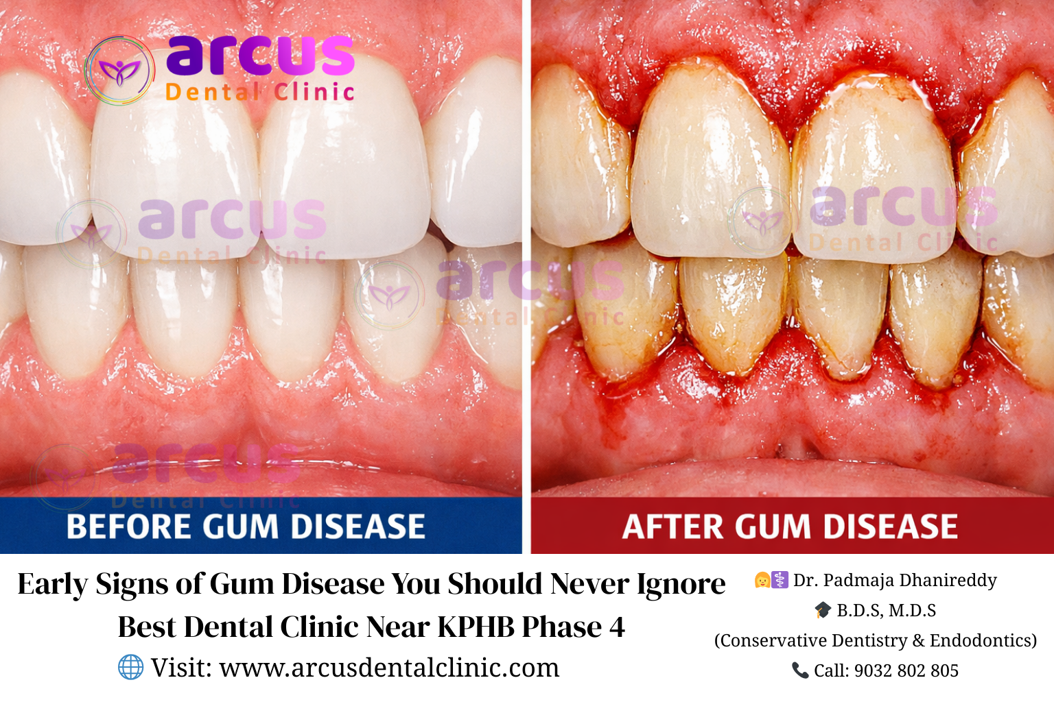 Best Dentist Near KPHB Phase 4