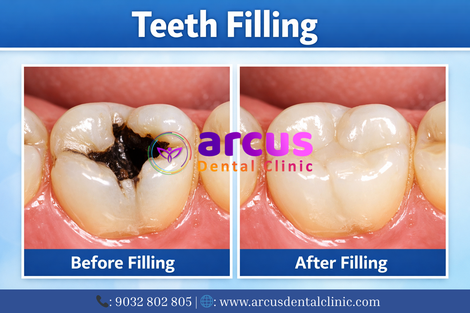 Best Dentist Near KPHB Phase 6