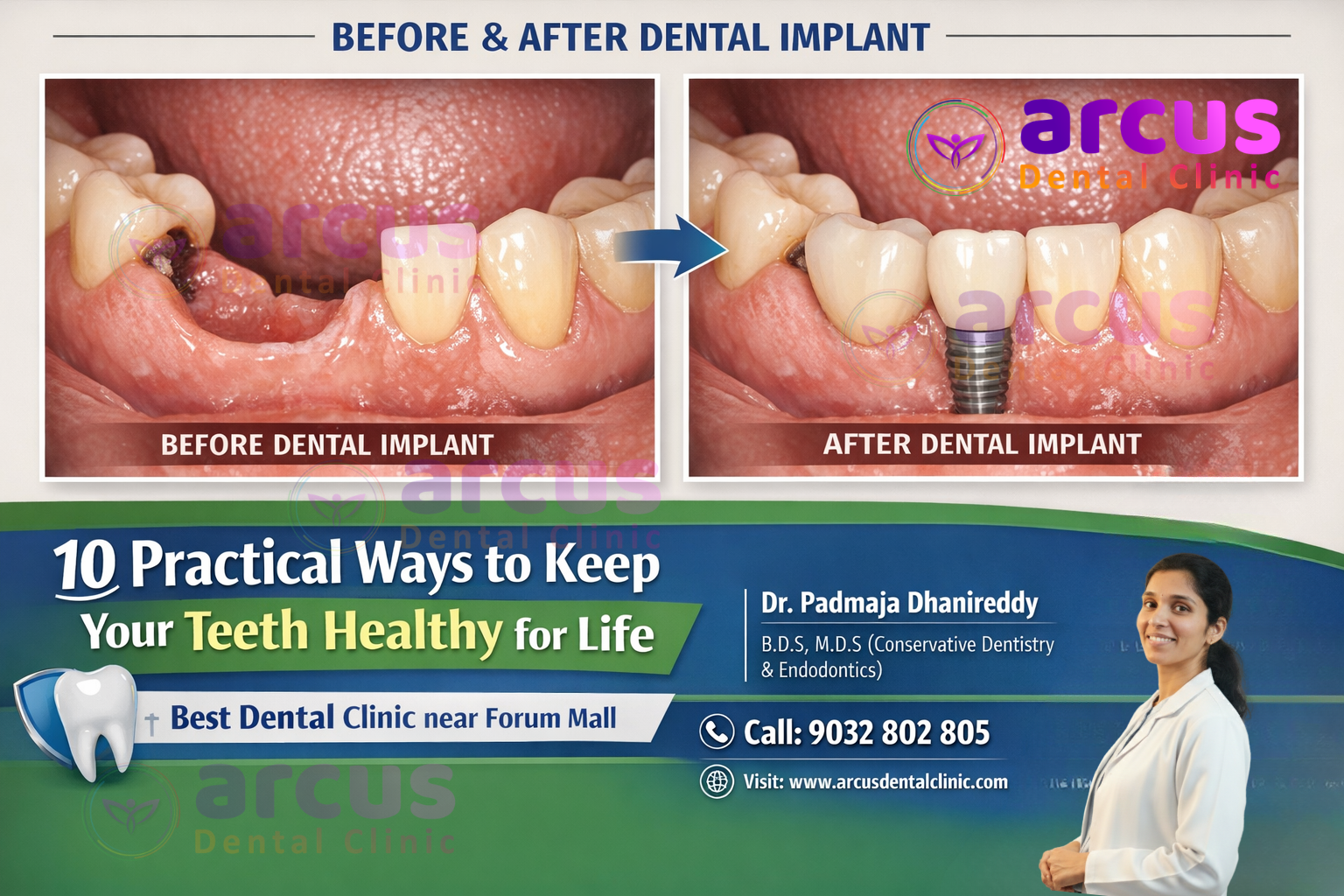 Best Dental Clinic near Forum Mall