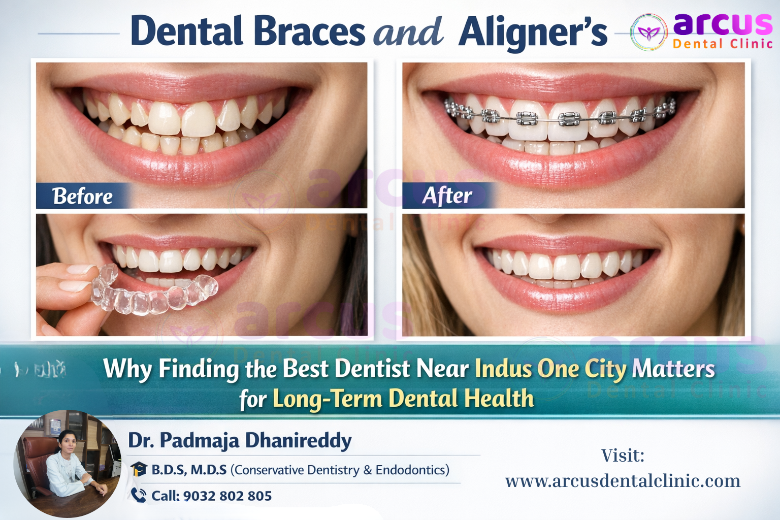 Best Dentist Near Indus One City