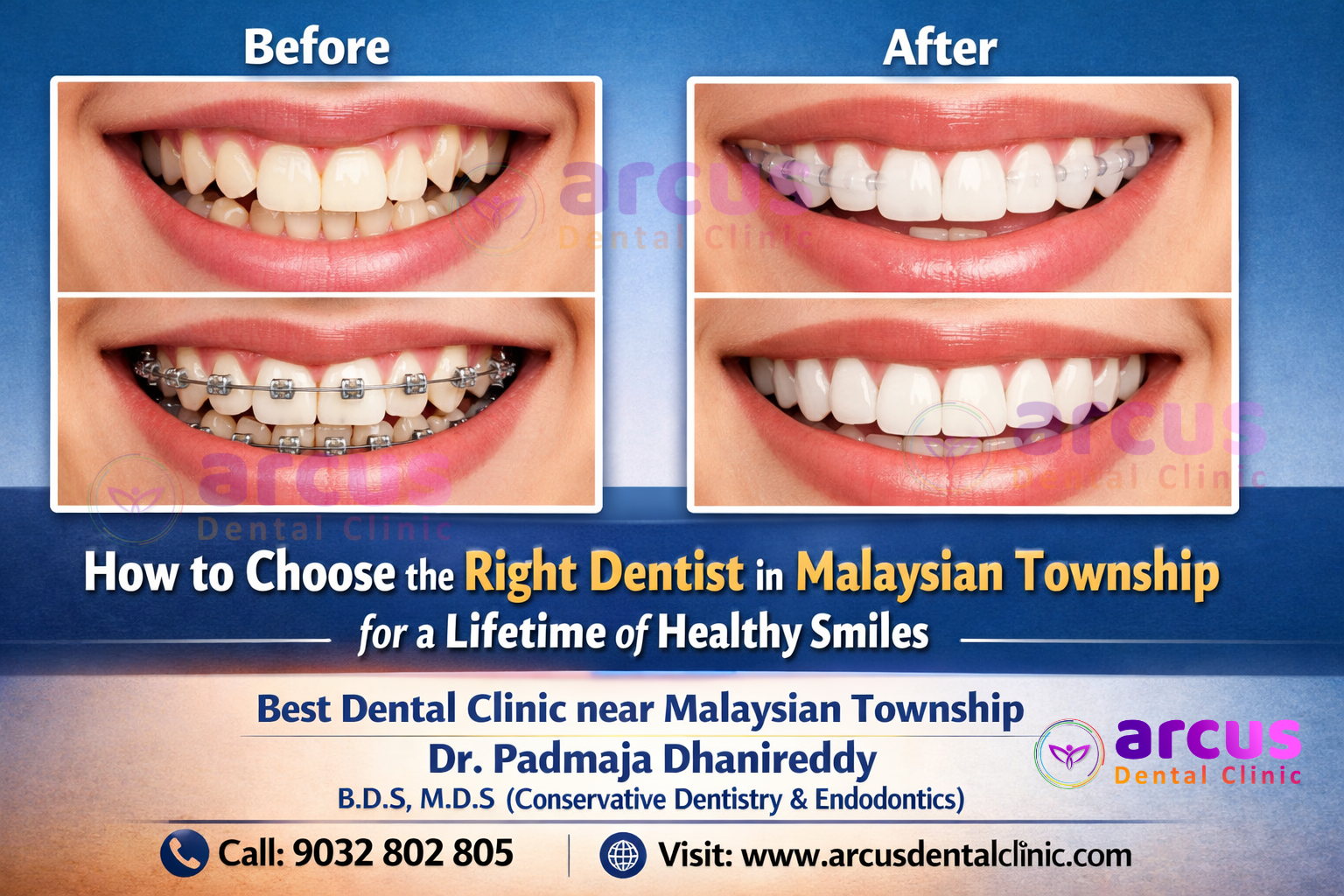 Best Dentist near Malaysian Township