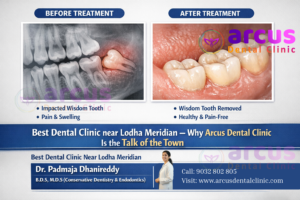 Best Dental Clinic Near Lodha Meridian