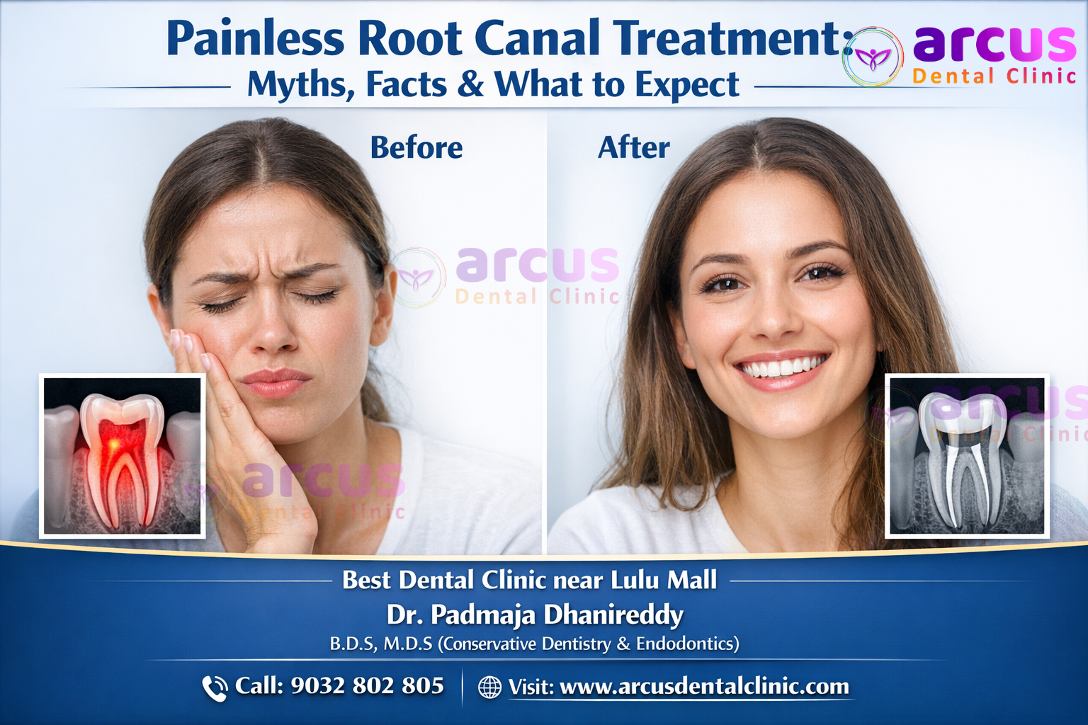 Best Dentist Near Lulu Mall Hyderabad