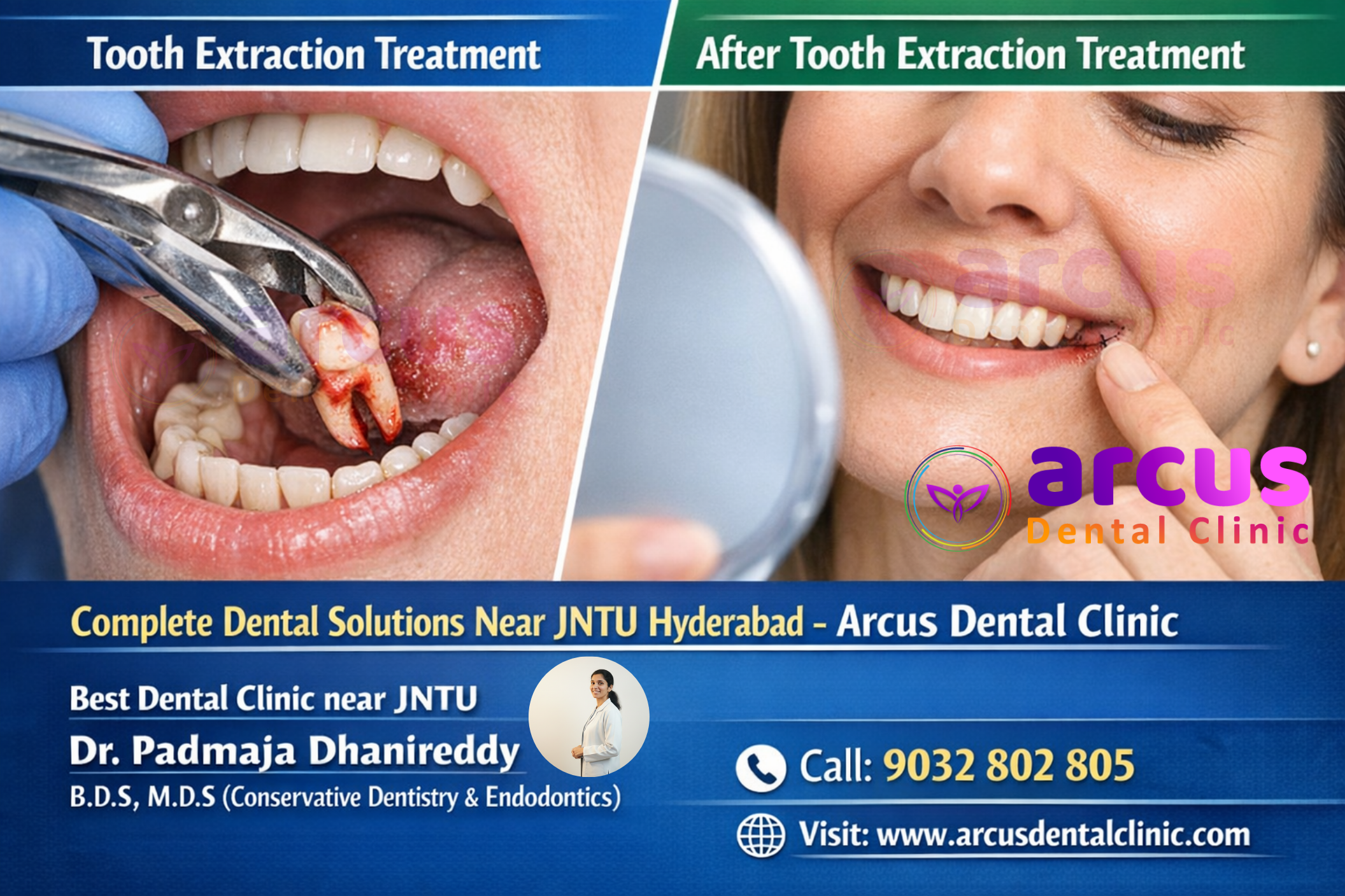 Best Dentist near JNTU