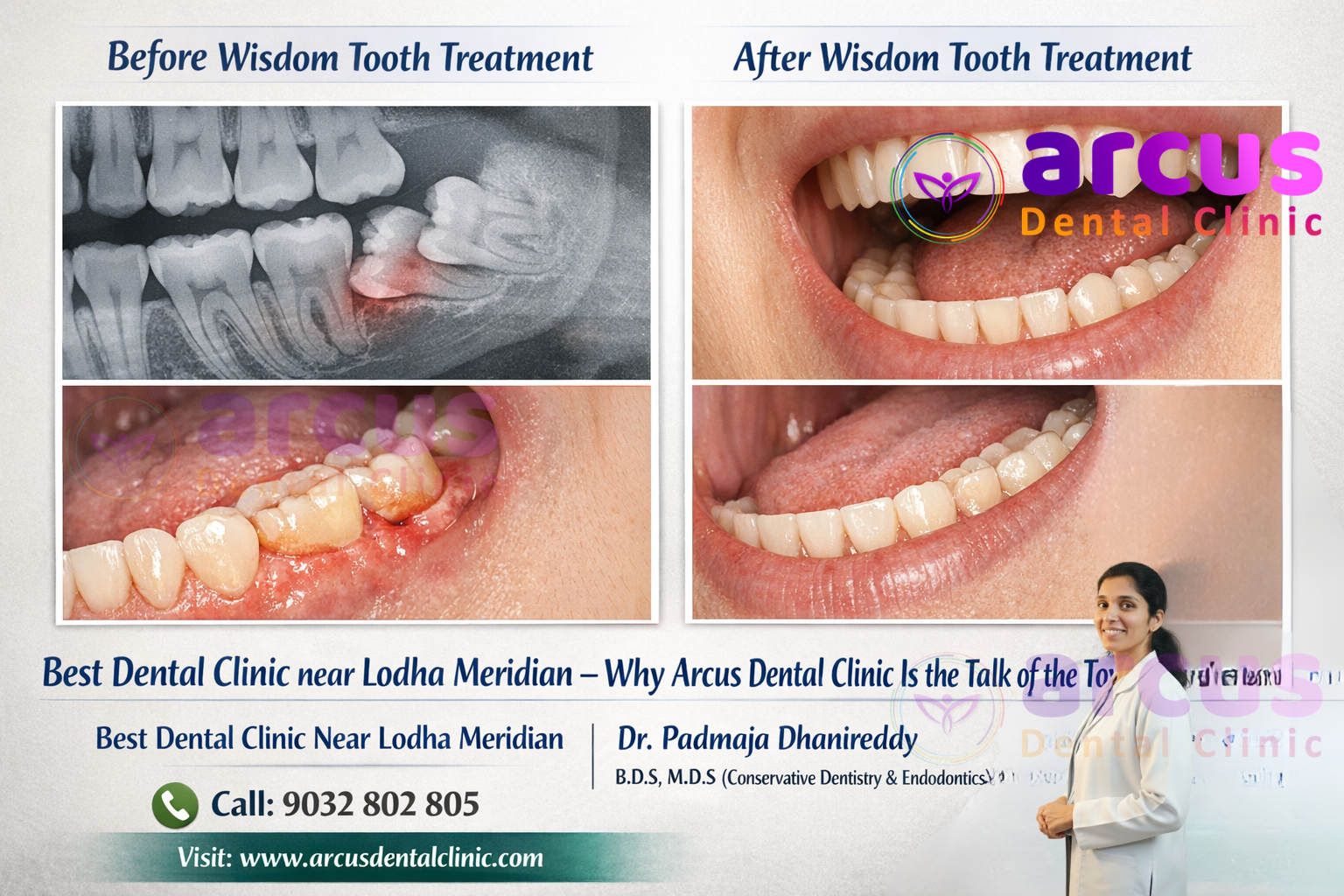 Best Dentist near Lodha Meridian
