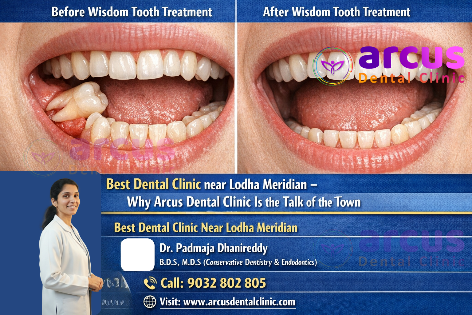 Best Dentist near Lodha Meridian