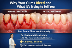 Best Dental Clinic Near Kukatpally