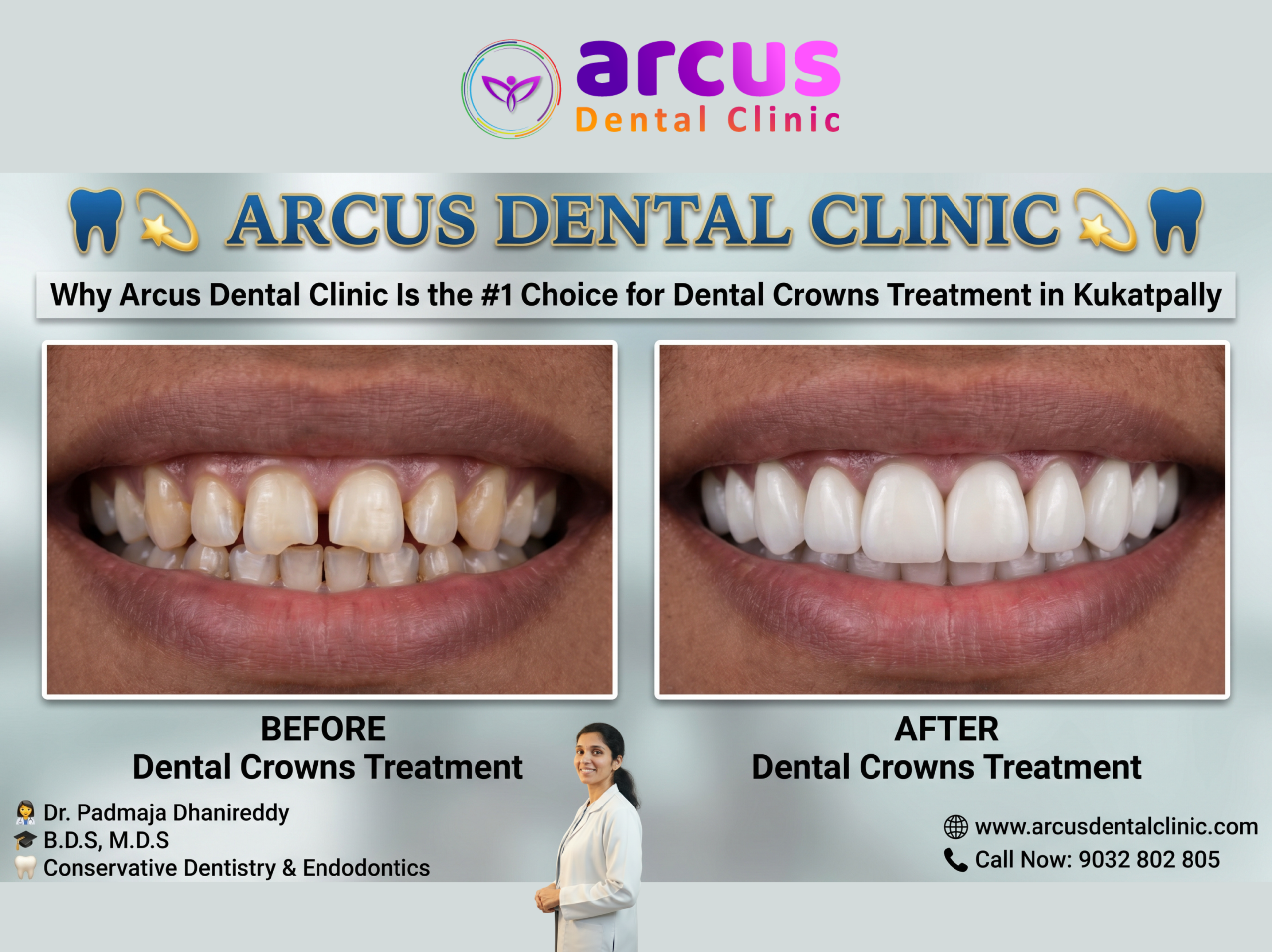 Best Dental Crowns Clinic In Kukatpally