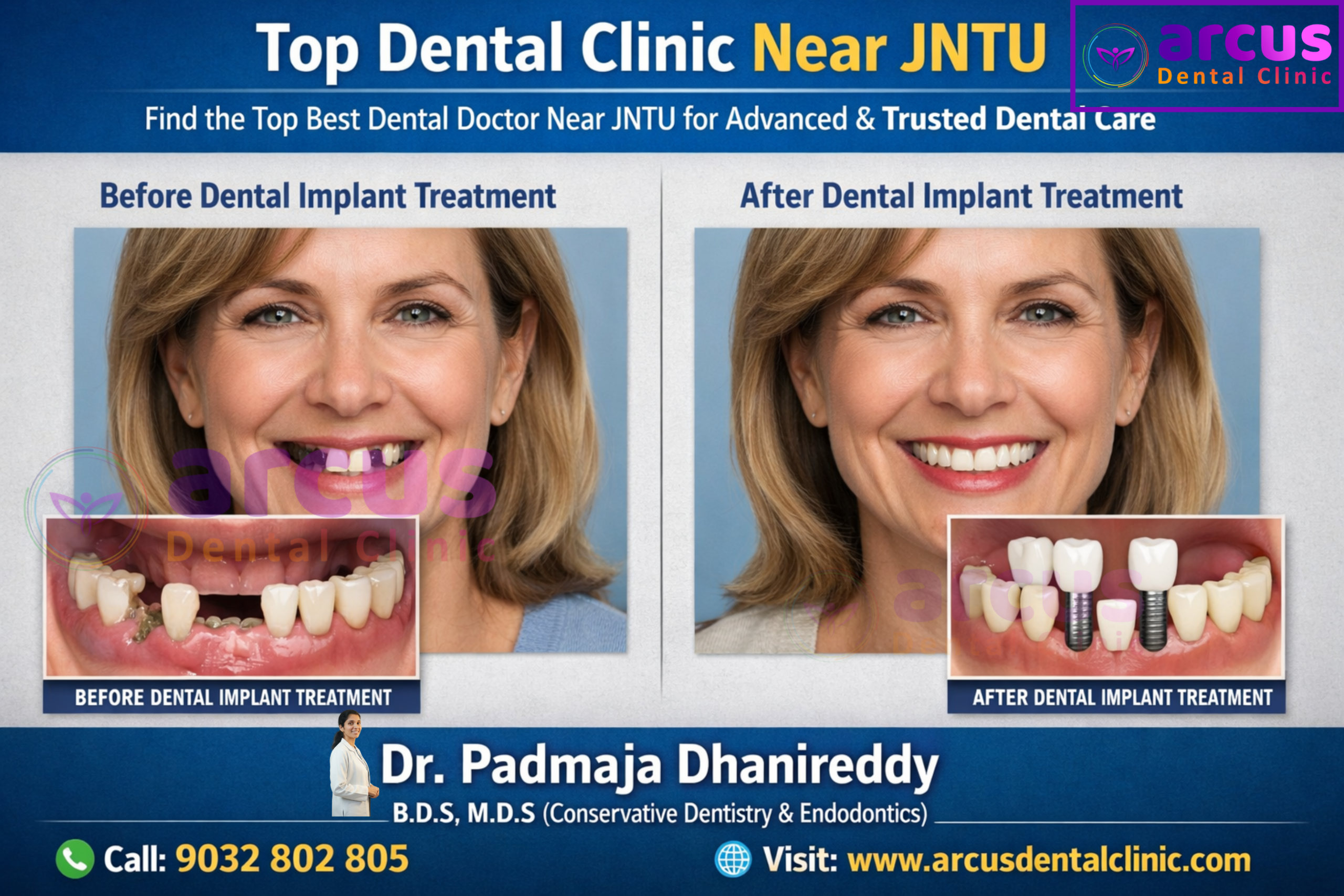 Top Dental Clinic Near JNTU Hyderabad